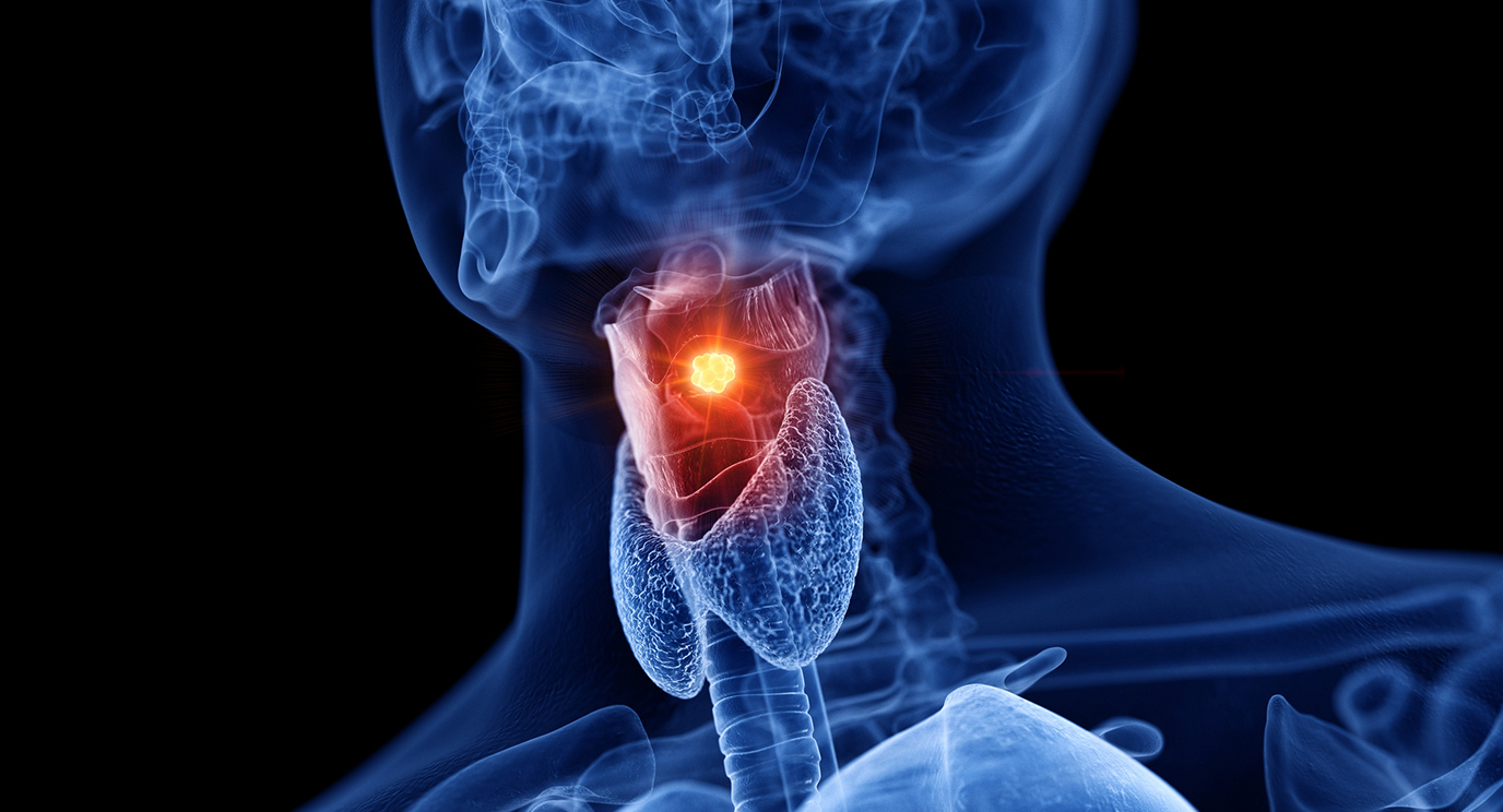 best doctor for laryngeal cancer in east delhi